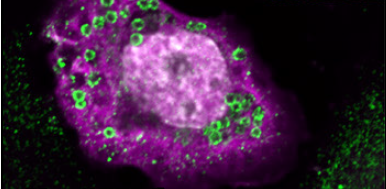 Un nouvel acteur contre les flavivirus neurotropes identifié (PNAS, 2025)